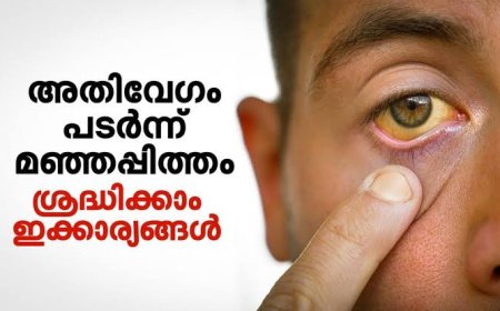 പാലക്കാട്ട് ഹെപ്പറ്റൈറ്റീസ് എ കേസുകൾ റിപ്പോർട്ട് ചെയ്തു; ജാഗ്രത പാലിക്കാൻ ആരോഗ്യവകുപ്പ് നിര്‍ദേശം