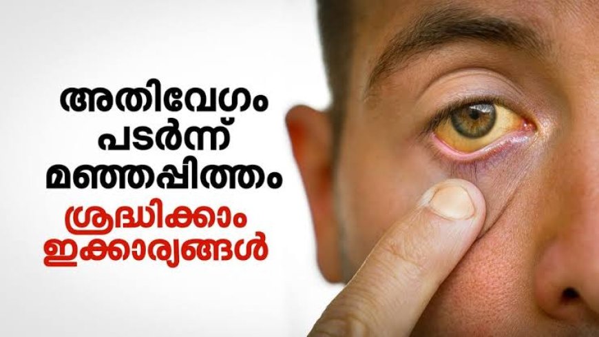 പാലക്കാട്ട് ഹെപ്പറ്റൈറ്റീസ് എ കേസുകൾ റിപ്പോർട്ട് ചെയ്തു; ജാഗ്രത പാലിക്കാൻ ആരോഗ്യവകുപ്പ് നിര്‍ദേശം