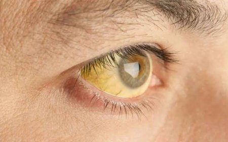 ജില്ലയില്‍ മഞ്ഞപ്പിത്തം (ഹെപ്പറ്റൈറ്റിസ്‌ എ) കേസുകള്‍ വര്‍ധിക്കുന്നു: ജാഗ്രതാ നിർദേശം