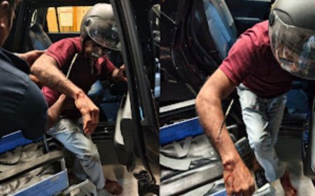 പാലാ നഗരത്തിന് സമീപം മുള്ളൻപന്നി ആക്രമണം; മധ്യവയസ്കന് ഗുരുതര പരിക്ക്